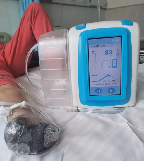 Dispositivo Npwt do sistema de terapia de pressão negativa para cicatrização de feridas com cartucho 1200